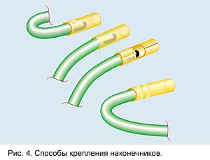 способы крепления наконечников